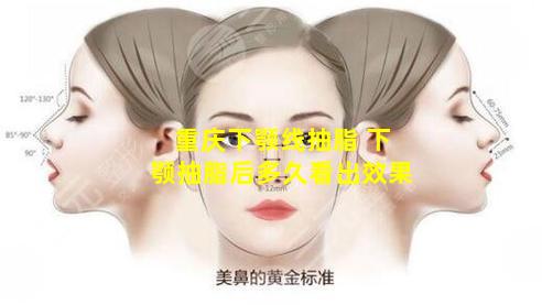 重庆下颚线抽脂 下颚抽脂后多久看出效果